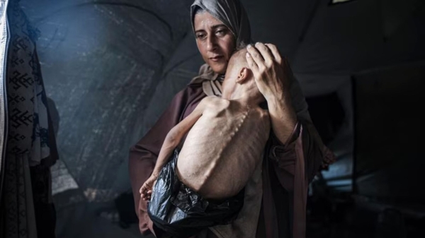 Голодающие дети и информационная война. Что на самом деле происходит в секторе Газа